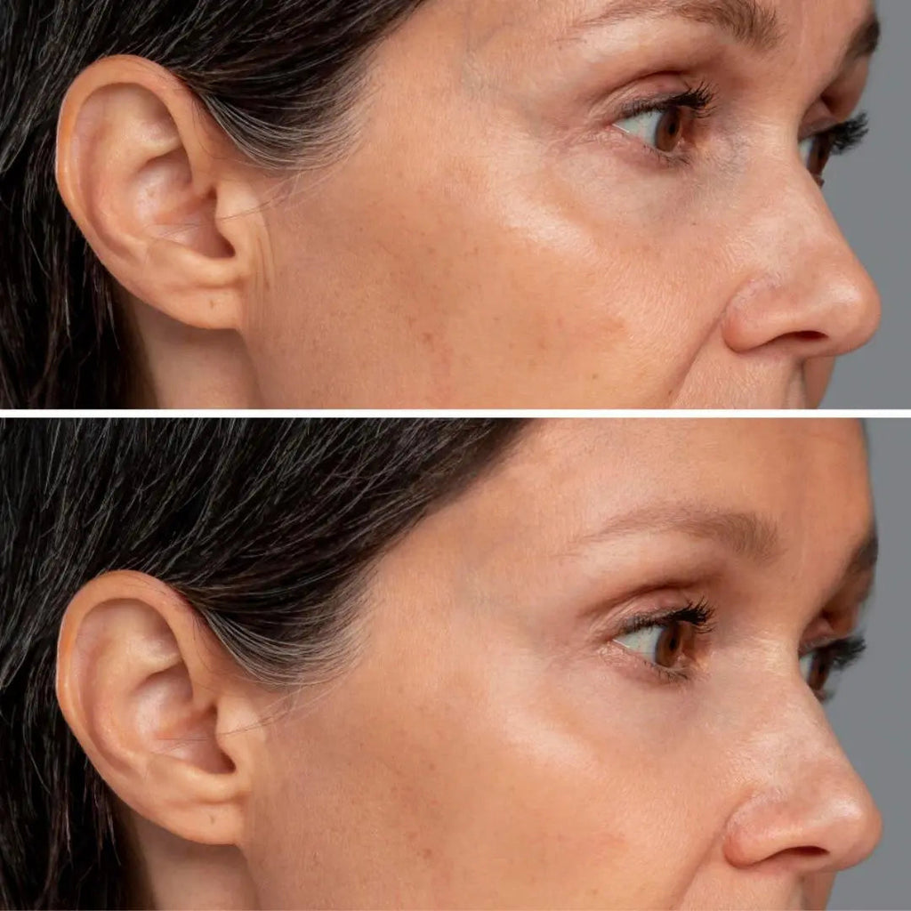 Kindle Eye Perfection Serum aftechskincare