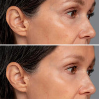 Kindle Eye Perfection Serum aftechskincare